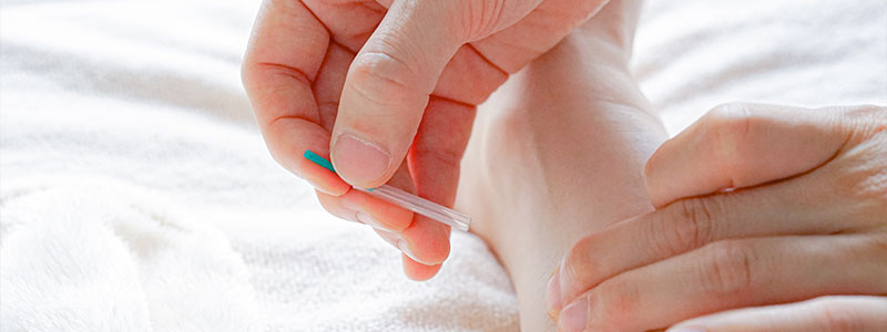 鍼灸のイメージ